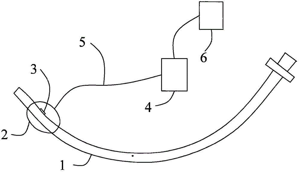 人工氣道氣囊壓力智能平衡系統(tǒng)的制作方法附圖